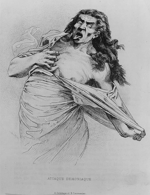 Ataque demoníaco, A. Delahaye e E. Lecrosnier, gravura para Études Cliniques sur la Grande Hystérie ou Hystéro-Épilepsie do Dr. Paul Richer, 1885