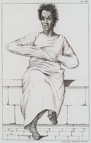 Litografia de Ambroise Tardieu para E. Esquirol,Des maladies mentales, Atlas, Paris, 1838